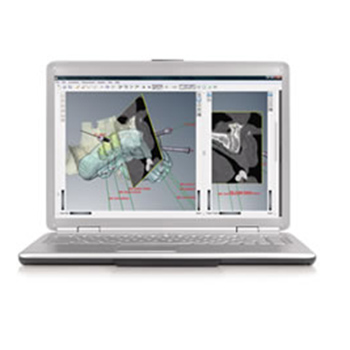DTX Studio Implant