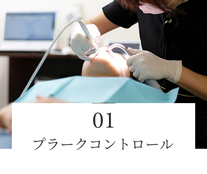 プラークコントロール
