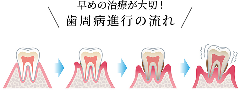 早めの治療が大切