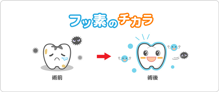 フッ素のチカラ