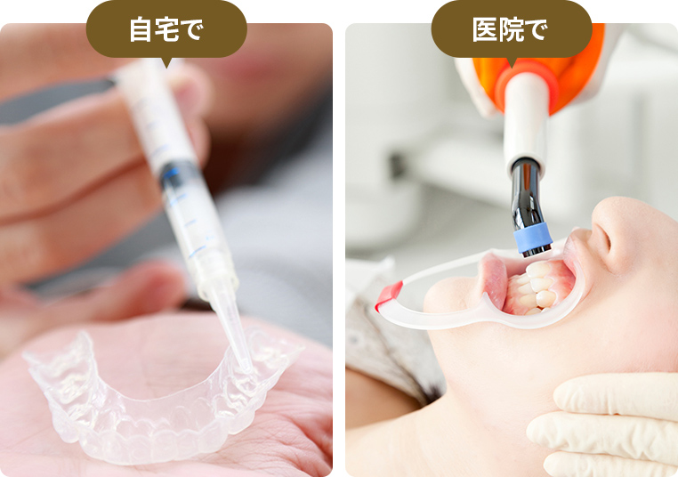 状態が悪くなる前にできる処置