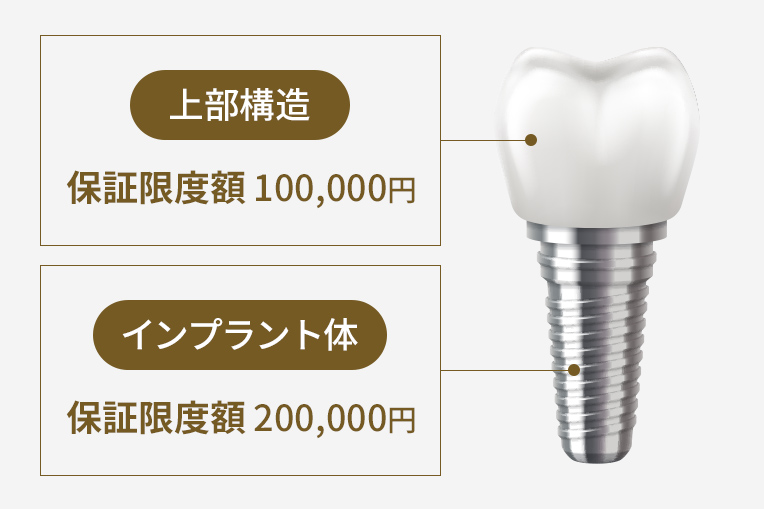 インプラント10年保証システムの詳しい保証内容