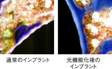 光機能化技術で骨インプラント接触率を98%以上にまで高められる!