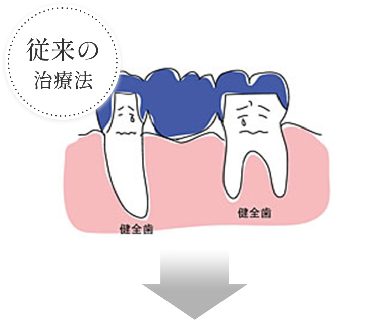 従来の治療法