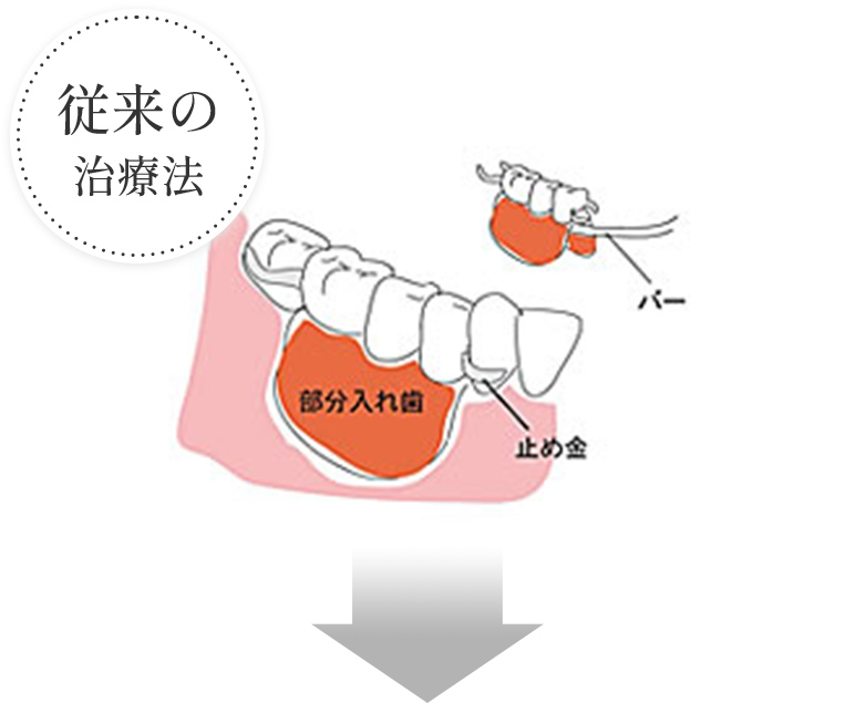 従来の治療法