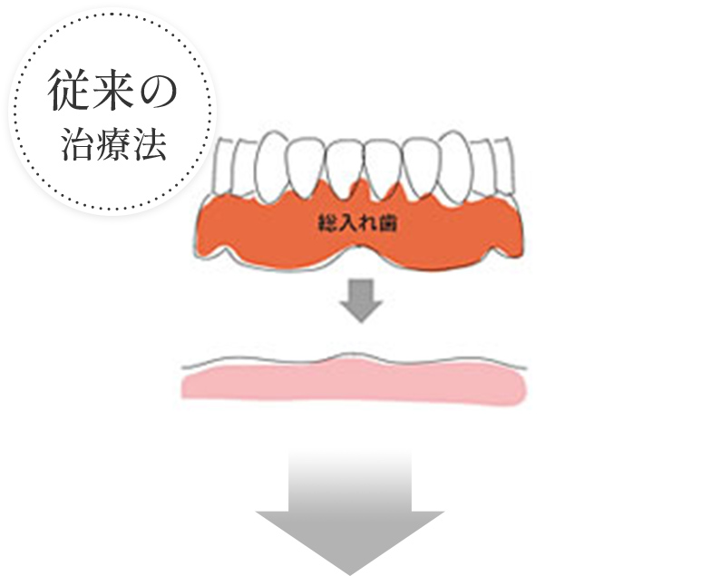 従来の治療法