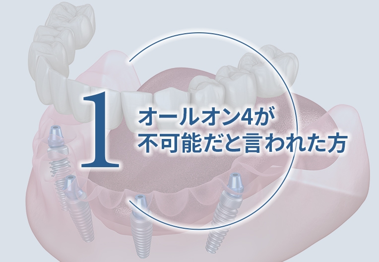上あごの骨がほとんどなくオールオン4が不可能だと言われた方