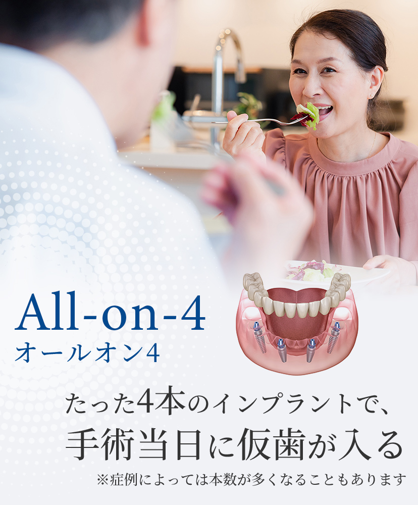 オールオン4