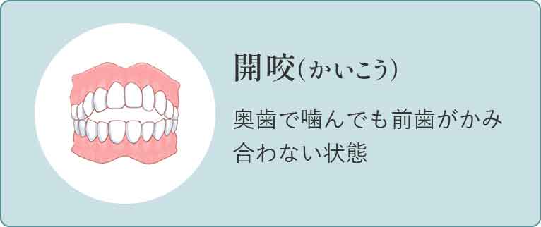 受け口