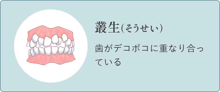 乱ぐい歯