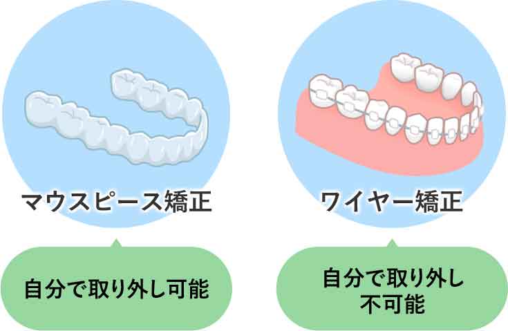取り外し可能かどうか