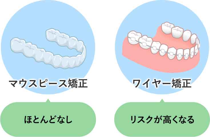むし歯・歯周病のリスク