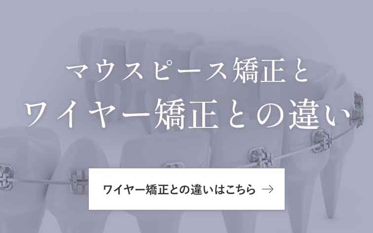 マウスピース矯正とワイヤー矯正との違い