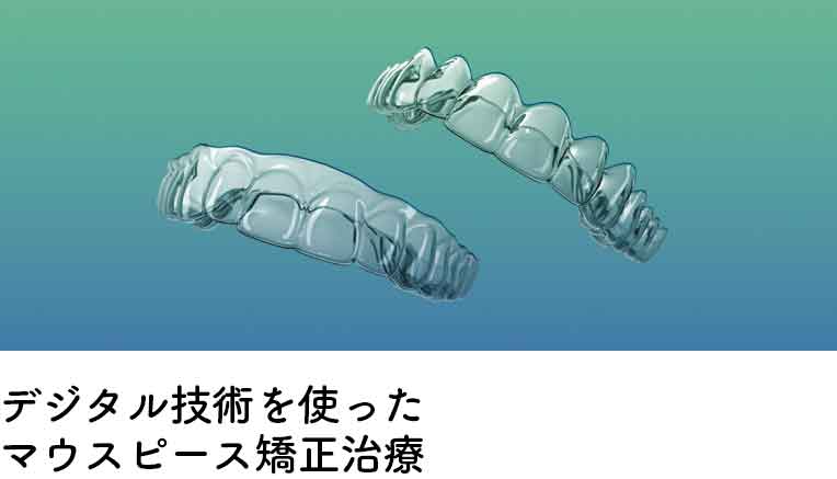 シュアスマイル SureSmile | しのぶ歯科 シュアスマイル SureSmile | しのぶ歯科