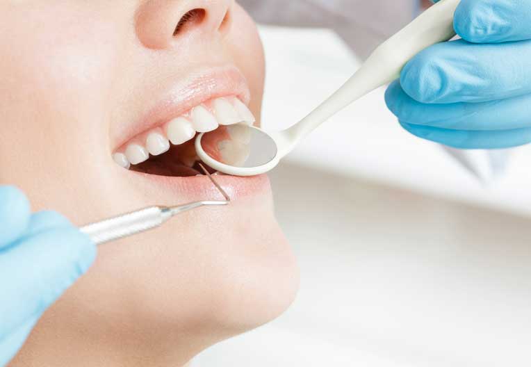 歯周病は進行性の病気