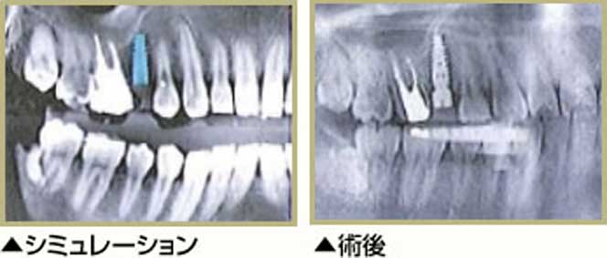 術後比較