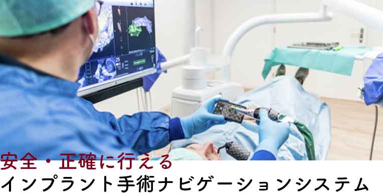 安全・正確に行えるインプラント手術ナビゲーションシステム
